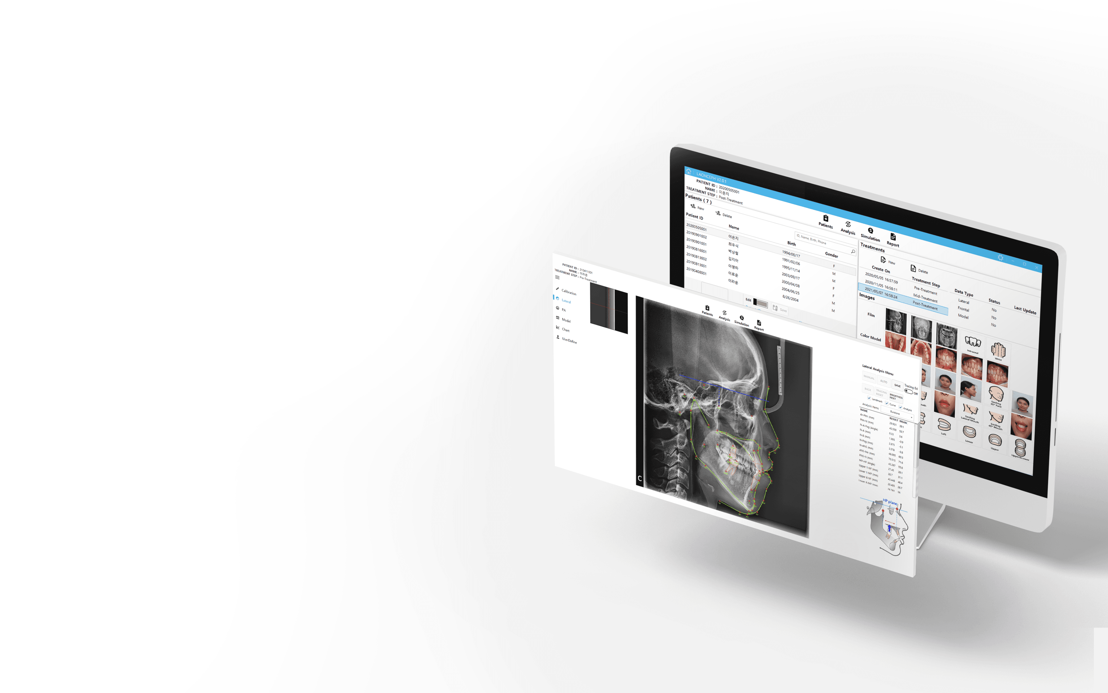 laonceph-trial-download